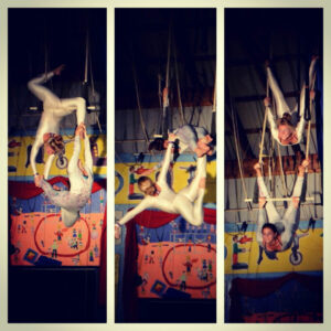 Corrective Osteotomy Hemi Hamate on Hyperextension Athlete Orthopedic Finger Surgeon Dr. Alejandro Badia Hand To Shoulder Miami Fl