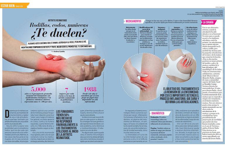 Artritis Reumatoide: Rodillas, codos, muñecas ¿Te duelen?