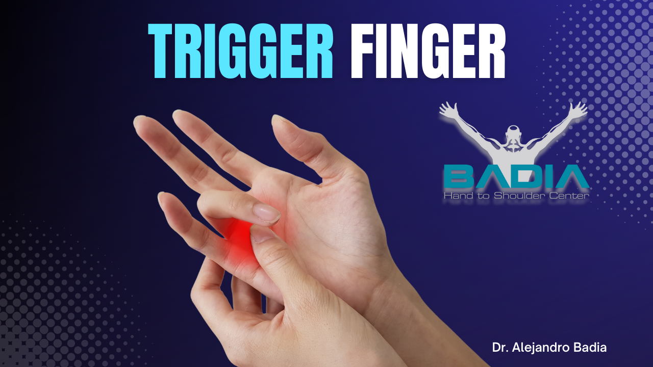 Trigger finger