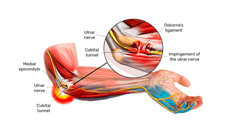 testimonial-ecuador-patient-02