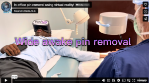 wide awake pin removal with vr