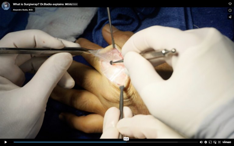 surgiwrap
