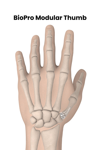 biopro-modular-thumb