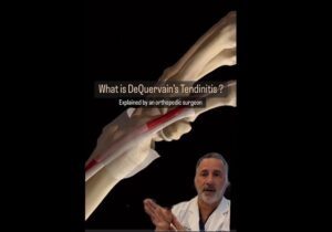 dequervains-video-pic