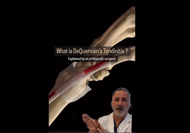 dequervains-video-pic