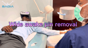 in-office-pin-removal-using-virtual-reality!