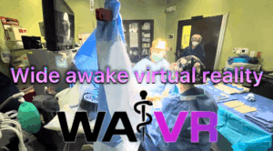 liberación-del-tunel-carpiano-y-dedo-en-gatillo-sin-sedación