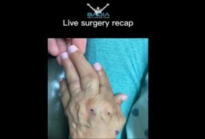 rheumatoid-arthritis-atient