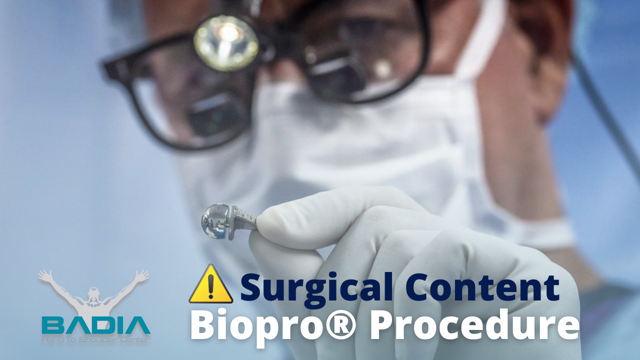 Step by Step BIOPRO Procedure - Dr. Badia Español