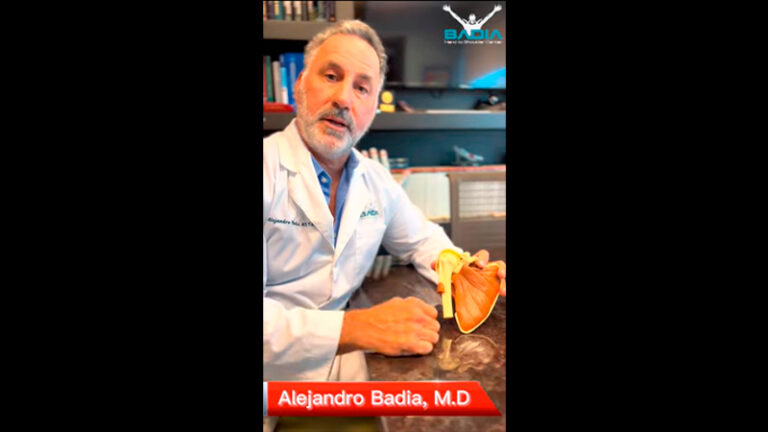 Ortho For Primary Care Collegues: Shoulder Instability