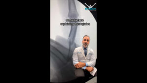 Dr.Badia Explains Finger Fractures & Why They Should Be Taken Seriously!