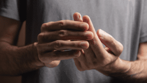 jammed finger injury