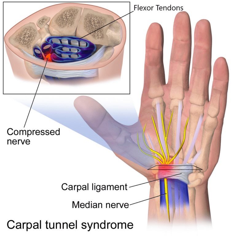 carpal tunnel anatomy