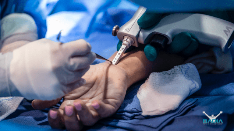 endoscopic carpal tunnel release