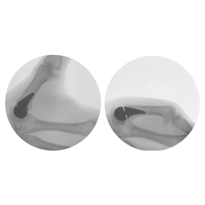 BIO PRO XRAY FLEXION