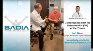 Joint Replacement for Osteoarthritis (OA) of the Thumb