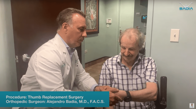 Thumb Replacement Surgery by Dr. Badia: Patient Testimonial