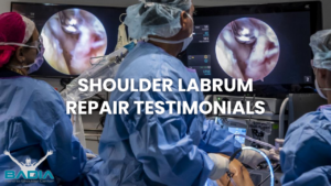 shoulder labrum repair