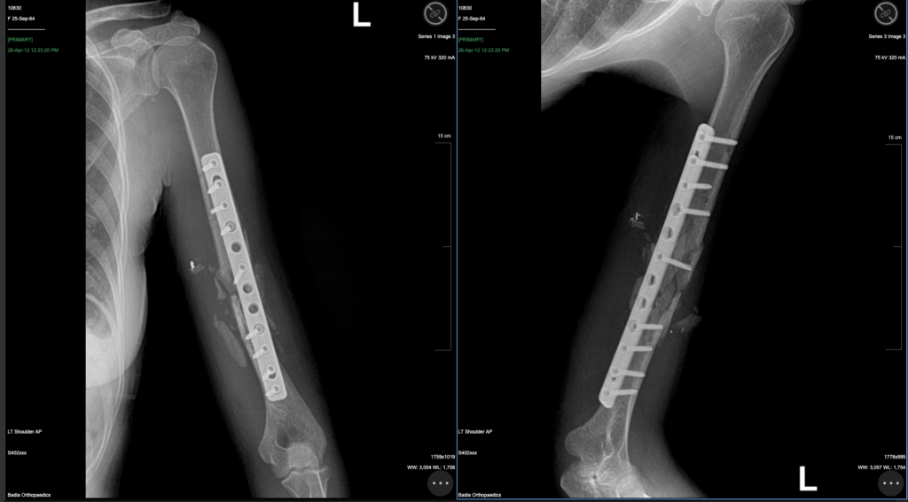 Christine chenet after