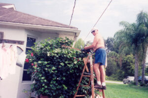 Finger Reattachment Surgery Of Amputation Of Four Fingers With A Circular Saw 2
