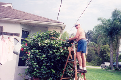 Finger Reattachment Surgery Of Amputation Of Four Fingers With A Circular Saw 2