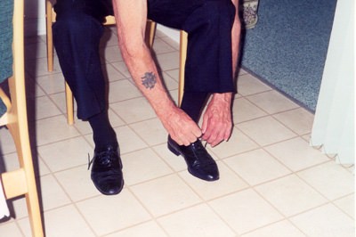 Finger Reattachment Surgery Of Amputation Of Four Fingers With A Circular Saw 3