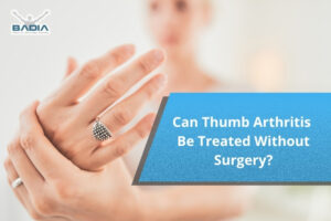 Can Thumb Arthritis Be Treated Without Surgery?