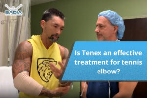 Is Tenex an effective treatment for tennis elbow (lateral epicondylitis)?