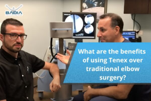 What are the benefits of using Tenex over traditional elbow surgery?