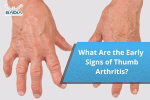 What Are the Early Signs of Thumb Arthritis?