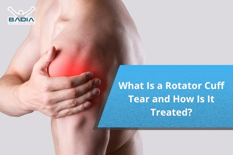 What Is a Rotator Cuff Tear and How Is It Treated?