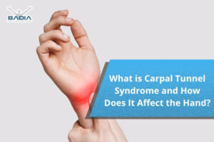 What is Carpal Tunnel Syndrome and How Does It Affect the Hand?