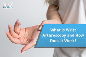 What Is Wrist Arthroscopy and How Does It Work?