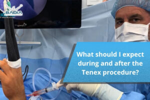 What should I expect during and after the Tenex procedure?