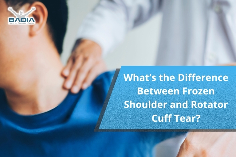 What’s the Difference Between Frozen Shoulder and Rotator Cuff Tear?