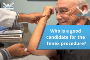 Who is a good candidate for the Tenex procedure?