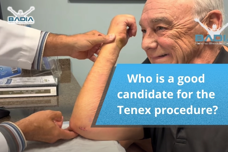 Who is a good candidate for the Tenex procedure?