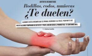 Dolor de muñeca – Artritis Reumatoide