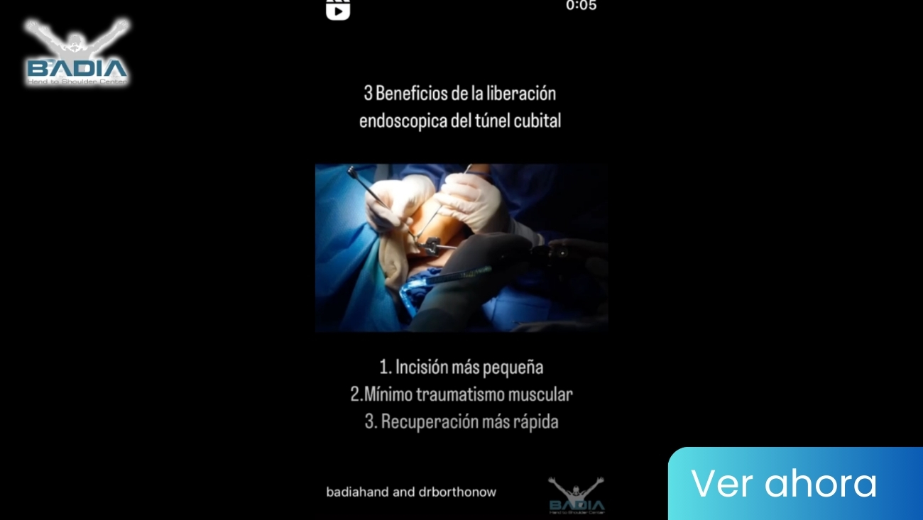 Benefits of Endoscopic Release: A Minimally Invasive Procedure for Elbow Pain