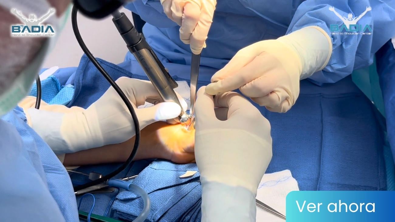 How much bone is removed during a thumb joint replacement procedure?