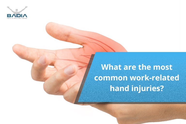 What are the most common work-related hand injuries?