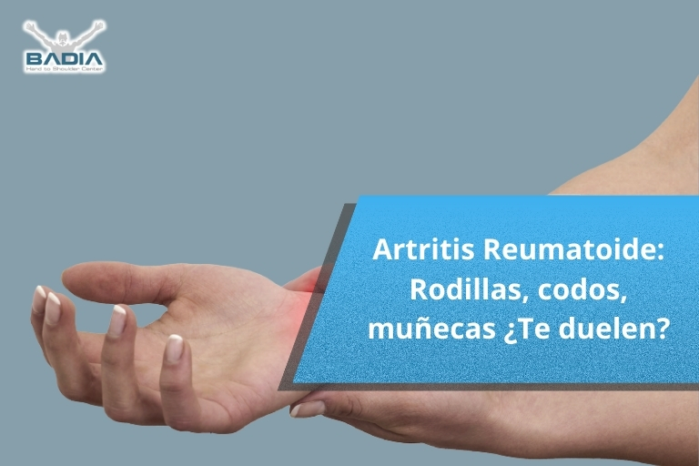 Artritis Reumatoide: Rodillas, codos, muñecas ¿Te duelen?