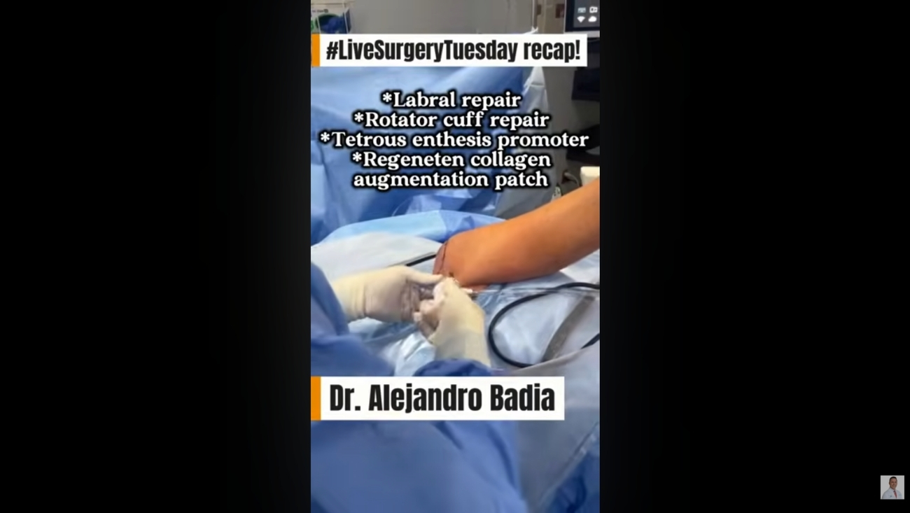 Reconstrucción compleja de hombro: Reparación labral y aumento del manguito rotador