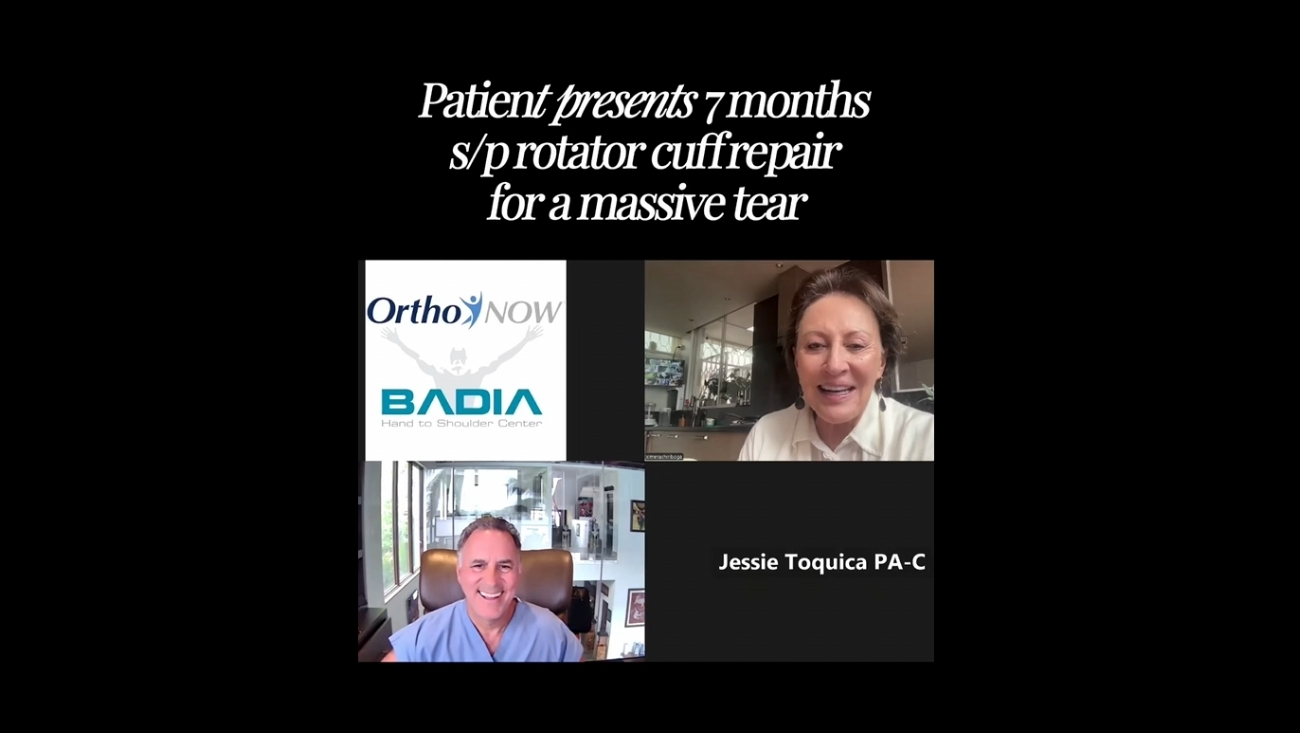 Tratamiento de bursitis con factores de crecimiento y PRP en el hombro