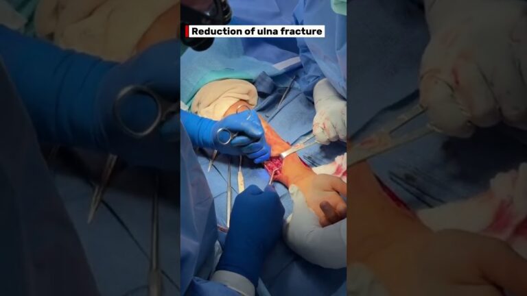 Resumen de #LiveSurgeryTuesday: RAFI de fractura de radio y cúbito