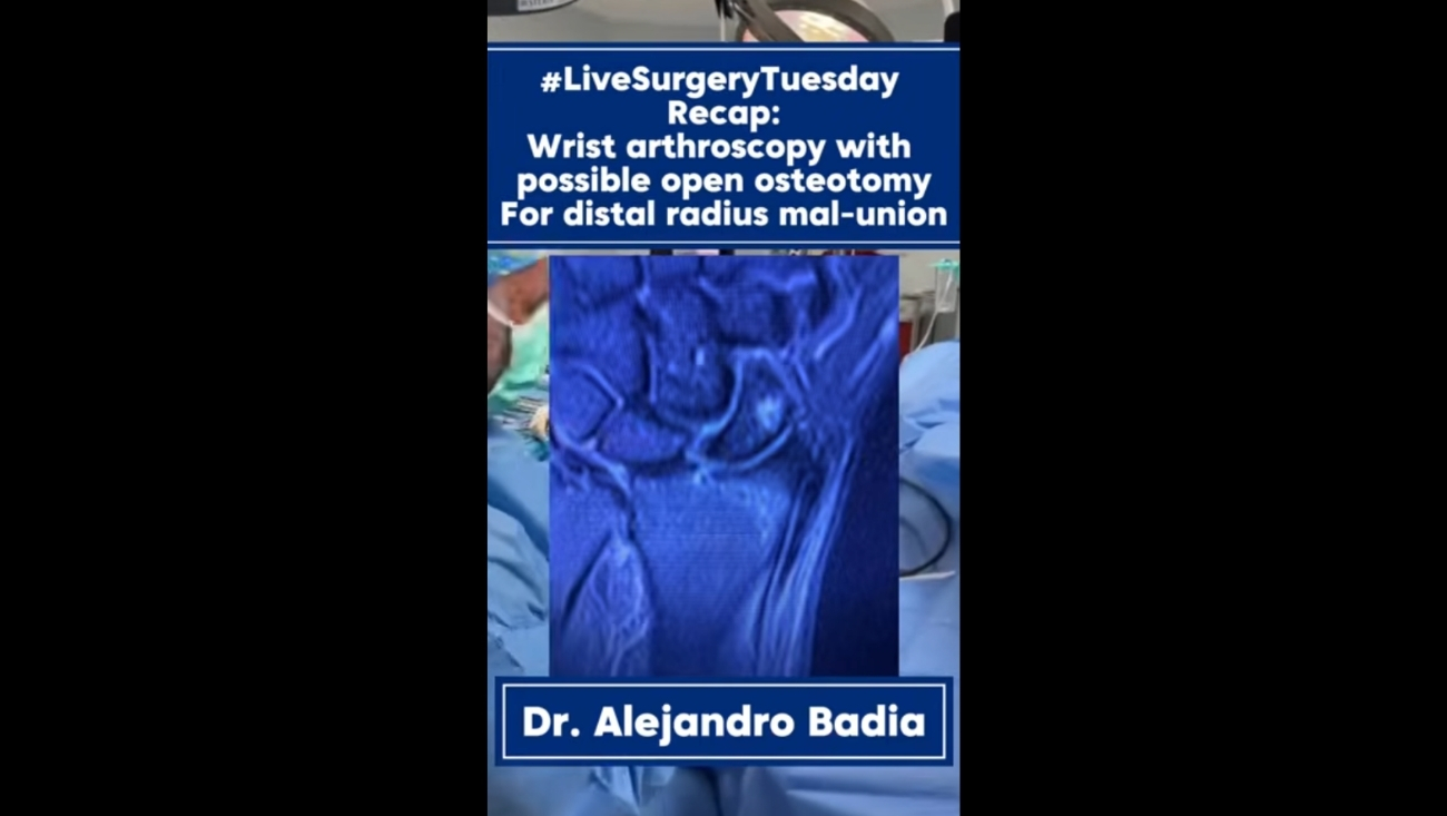 #LiveSurgeryTuesday: Artroscopia de muñeca con posible osteotomía abierta por consolidación viciosa del radio distal
