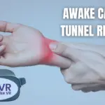 Awake carpal tunnel release