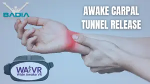 Awake carpal tunnel release