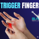 Trigger finger