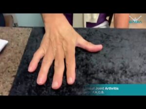 Sustitución de la articulación del pulgar para la artritis de la articulación basal